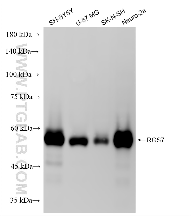 Western Blot (WB) analysis of various lysates using RGS7 Recombinant monoclonal antibody (86846-2-RR)