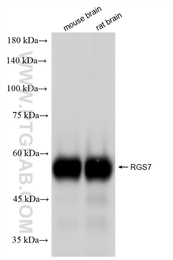Western Blot (WB) analysis of various lysates using RGS7 Recombinant monoclonal antibody (86846-2-RR)