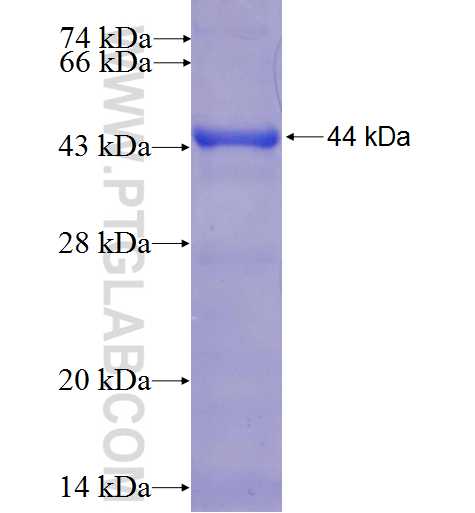 RGS7 fusion protein Ag5181 SDS-PAGE