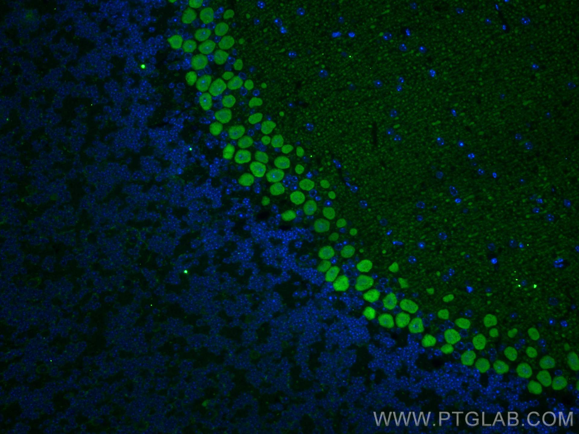 IF Staining of mouse cerebellum using 27394-1-AP