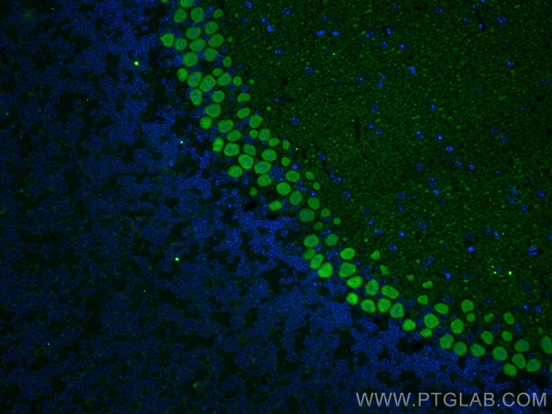 Immunofluorescence (IF) / fluorescent staining of mouse cerebellum tissue using RGS8 Polyclonal antibody (27394-1-AP)