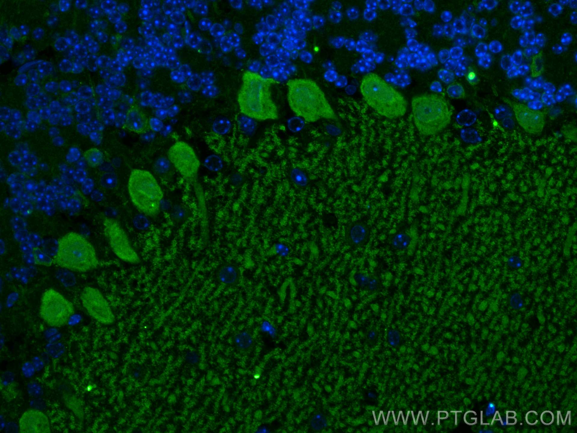 IF Staining of mouse cerebellum using 27394-1-AP