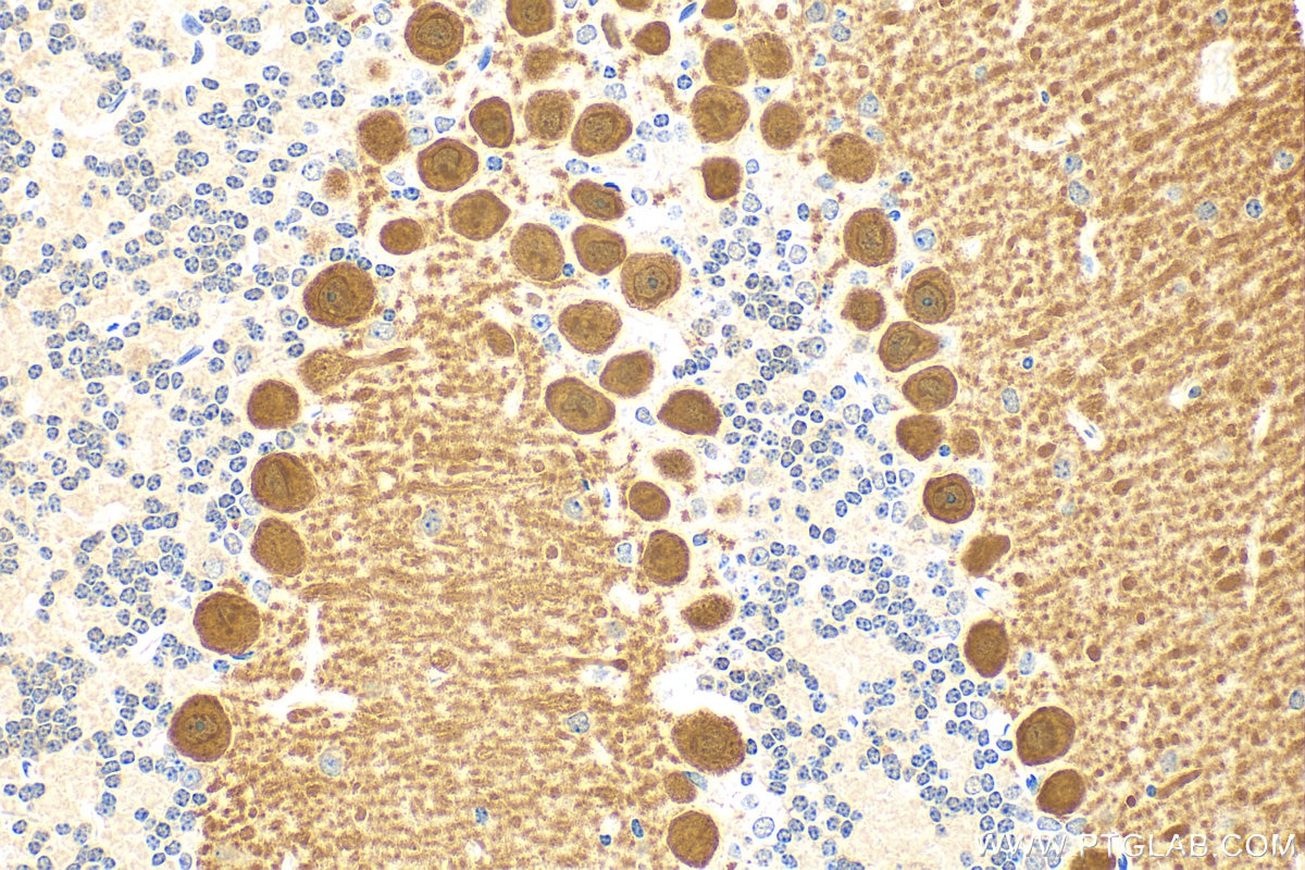 Immunohistochemistry (IHC) staining of mouse cerebellum tissue using RGS8 Polyclonal antibody (27394-1-AP)
