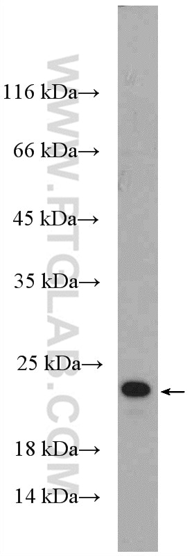 Western Blot (WB) analysis of mouse liver tissue using RGS8 Polyclonal antibody (27394-1-AP)