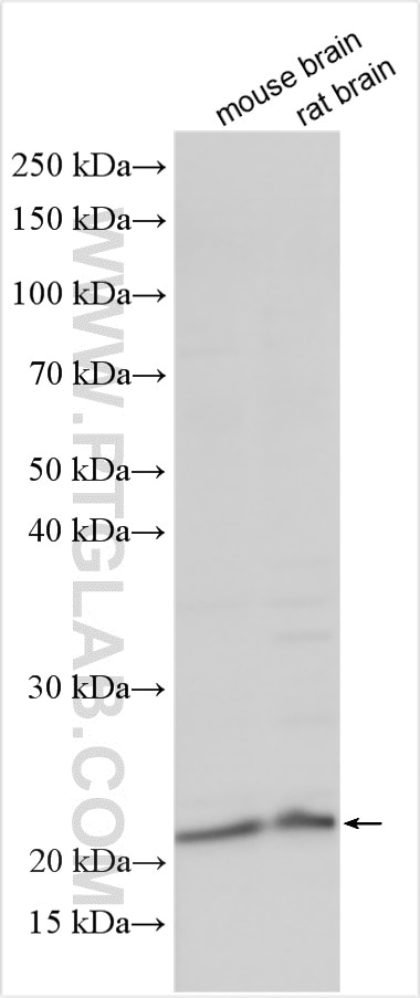 Western Blot (WB) analysis of various lysates using RGS8 Polyclonal antibody (27394-1-AP)