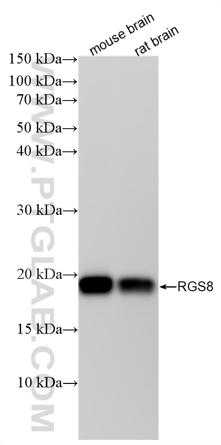 WB analysis using 88102-1-RR (same clone as 88102-1-PBS) Western Blot (WB) analysis of various lysates using RGS8 Recombinant monoclonal antibody (88102-1-RR)