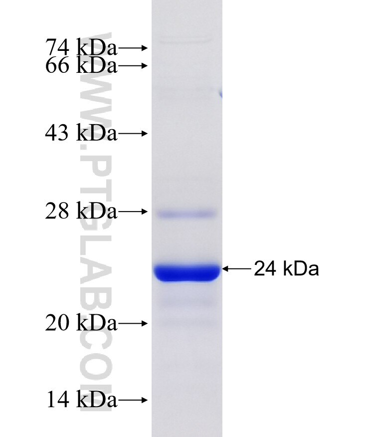 RGS8 fusion protein Ag26561 SDS-PAGE
