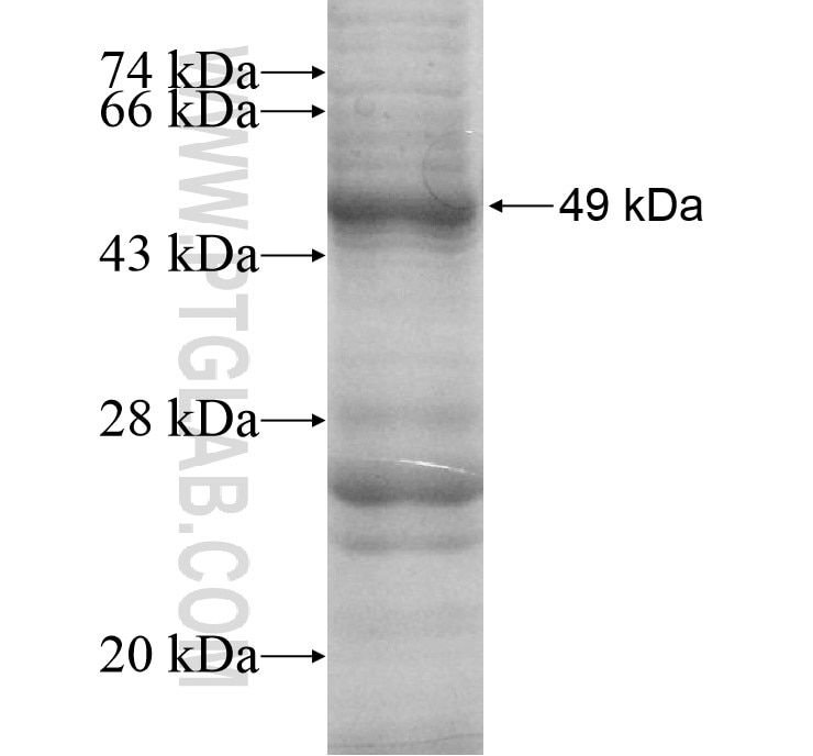 RGS8 fusion protein Ag12799 SDS-PAGE