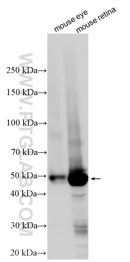Western Blot (WB) analysis of various lysates using RGS9 Polyclonal antibody (17970-1-AP)