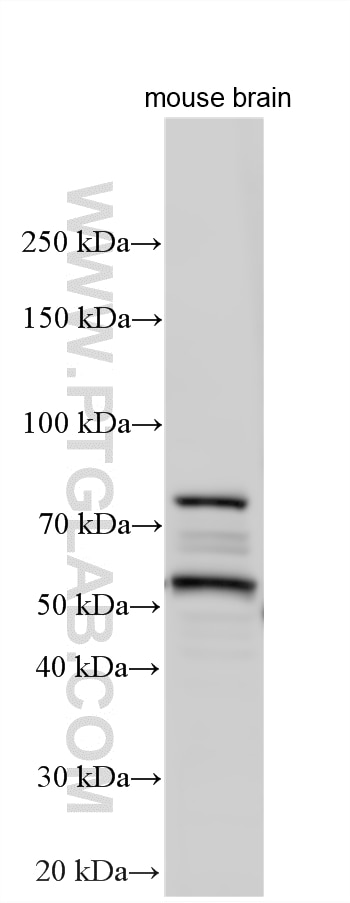 Western Blot (WB) analysis of mouse brain tissue using RGS9 Polyclonal antibody (17970-1-AP)