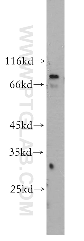 Western Blot (WB) analysis of SH-SY5Y cells using RGS9 Polyclonal antibody (17970-1-AP)