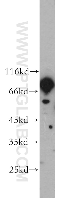 Western Blot (WB) analysis of mouse brain tissue using RGS9 Polyclonal antibody (17970-1-AP)