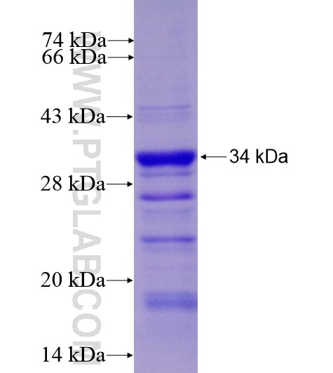 RGS9 fusion protein Ag11976 SDS-PAGE