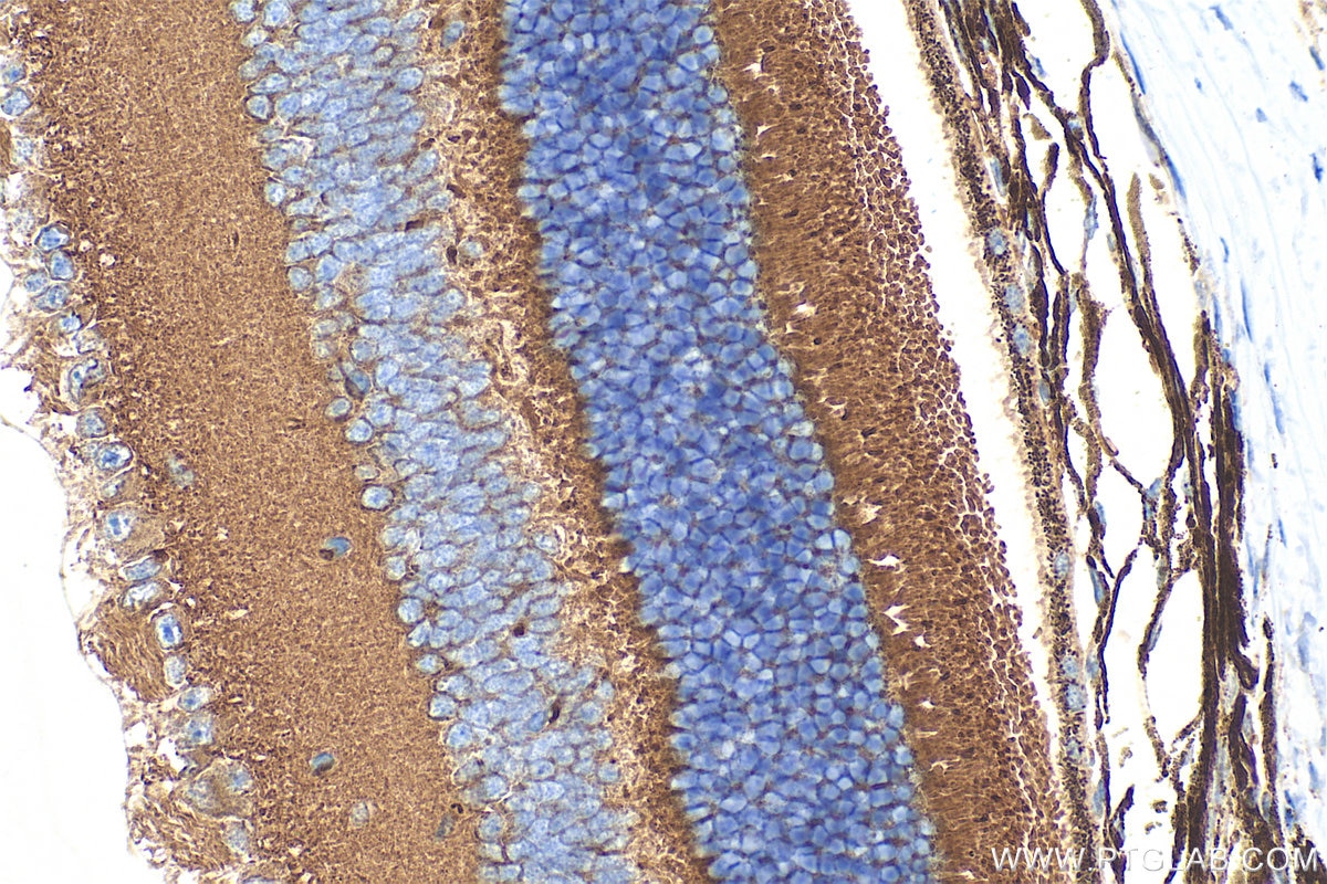 Immunohistochemistry (IHC) staining of mouse eye tissue using RGS9BP Polyclonal antibody (33040-1-AP)