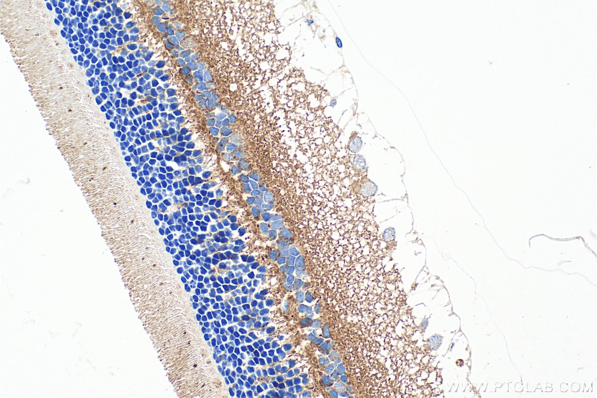 Immunohistochemistry (IHC) staining of rat eye tissue using RGS9BP Polyclonal antibody (33040-1-AP)