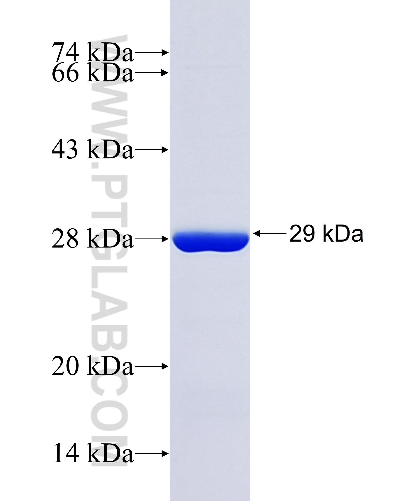 RGS9BP fusion protein Ag37846 SDS-PAGE RGS9BP fusion protein Ag37846 SDS-PAGE