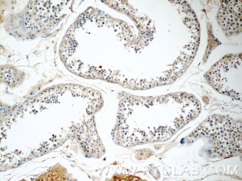 Immunohistochemistry (IHC) staining of human testis tissue using RGSL1 Polyclonal antibody (25836-1-AP)