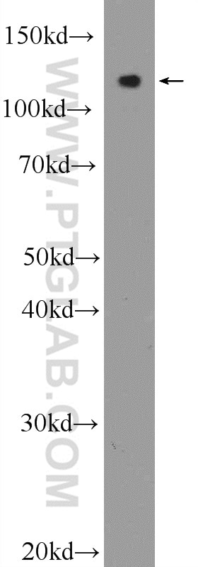 Western Blot (WB) analysis of mouse brain tissue using RGSL1 Polyclonal antibody (25836-1-AP)