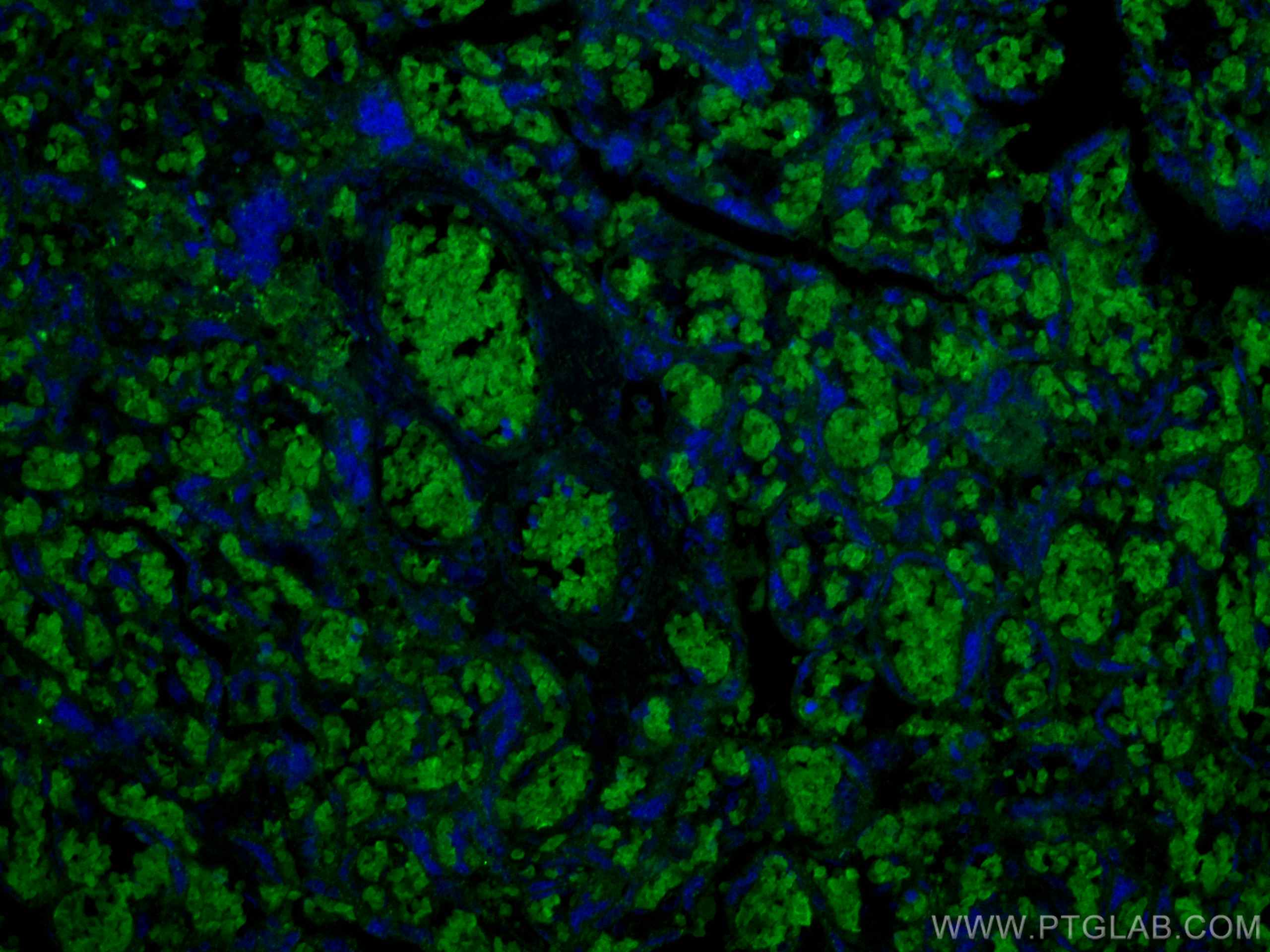 Immunofluorescence (IF) / fluorescent staining of human placenta tissue using RHAG Monoclonal antibody (67714-1-Ig)