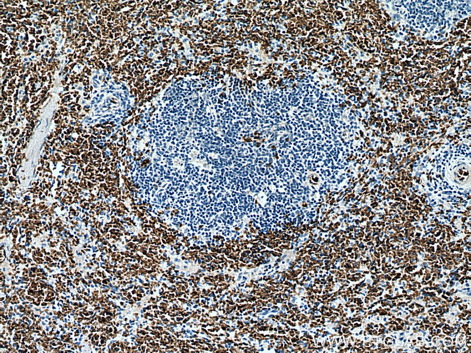 Immunohistochemistry (IHC) staining of human spleen tissue using RHAG Monoclonal antibody (67714-1-Ig)