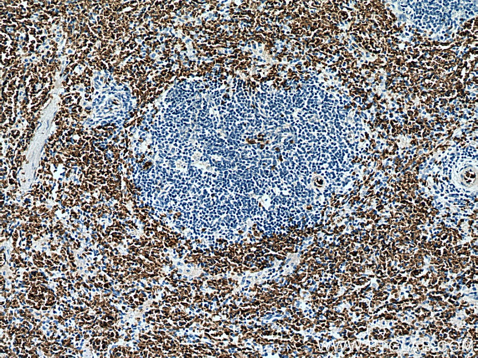 IHC staining of human spleen using 67714-1-Ig