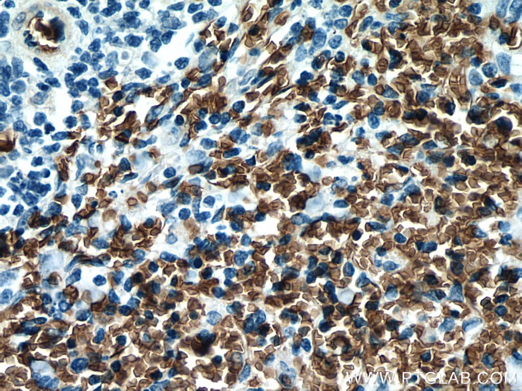 Immunohistochemistry (IHC) staining of human spleen tissue using RHAG Monoclonal antibody (67714-1-Ig)