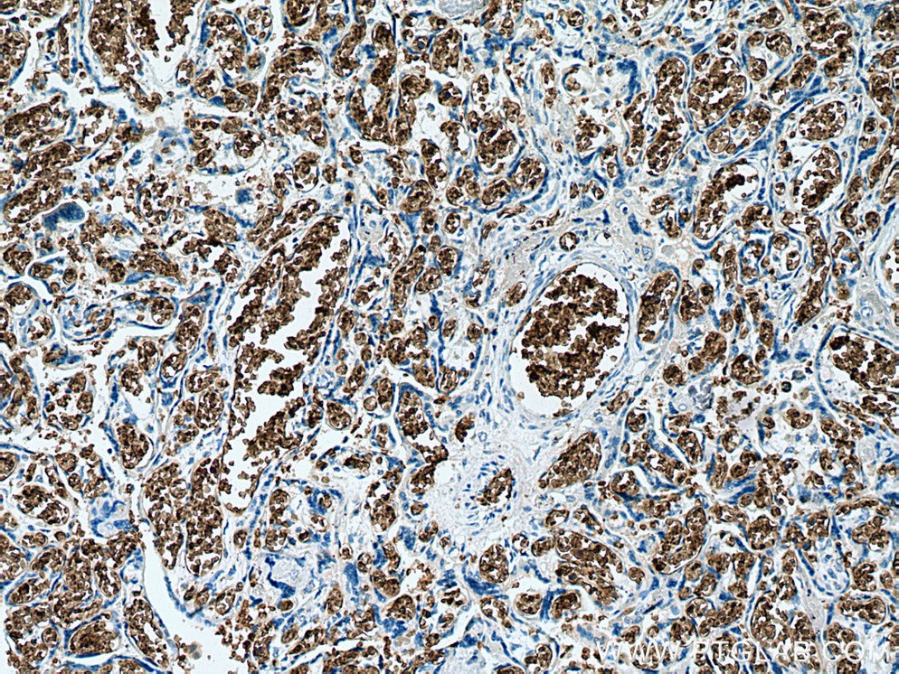 Immunohistochemistry (IHC) staining of human placenta tissue using RHAG Monoclonal antibody (67714-1-Ig)