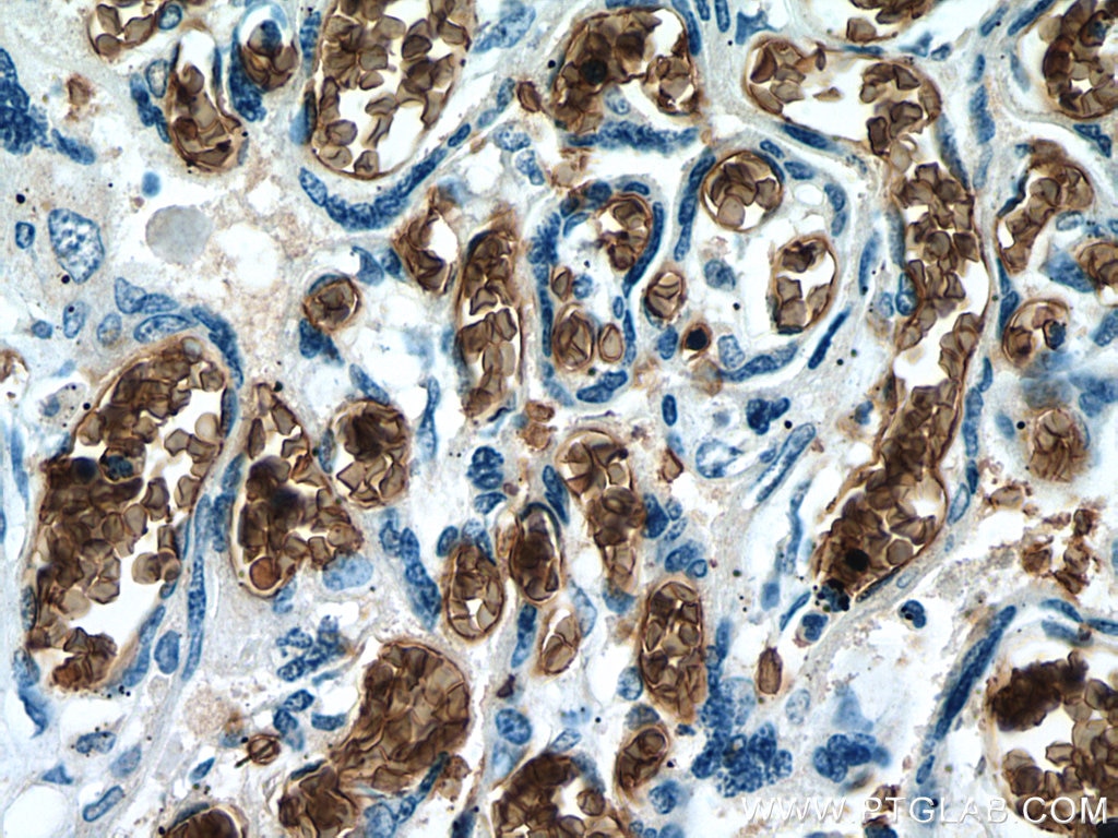 Immunohistochemistry (IHC) staining of human placenta tissue using RHAG Monoclonal antibody (67714-1-Ig)