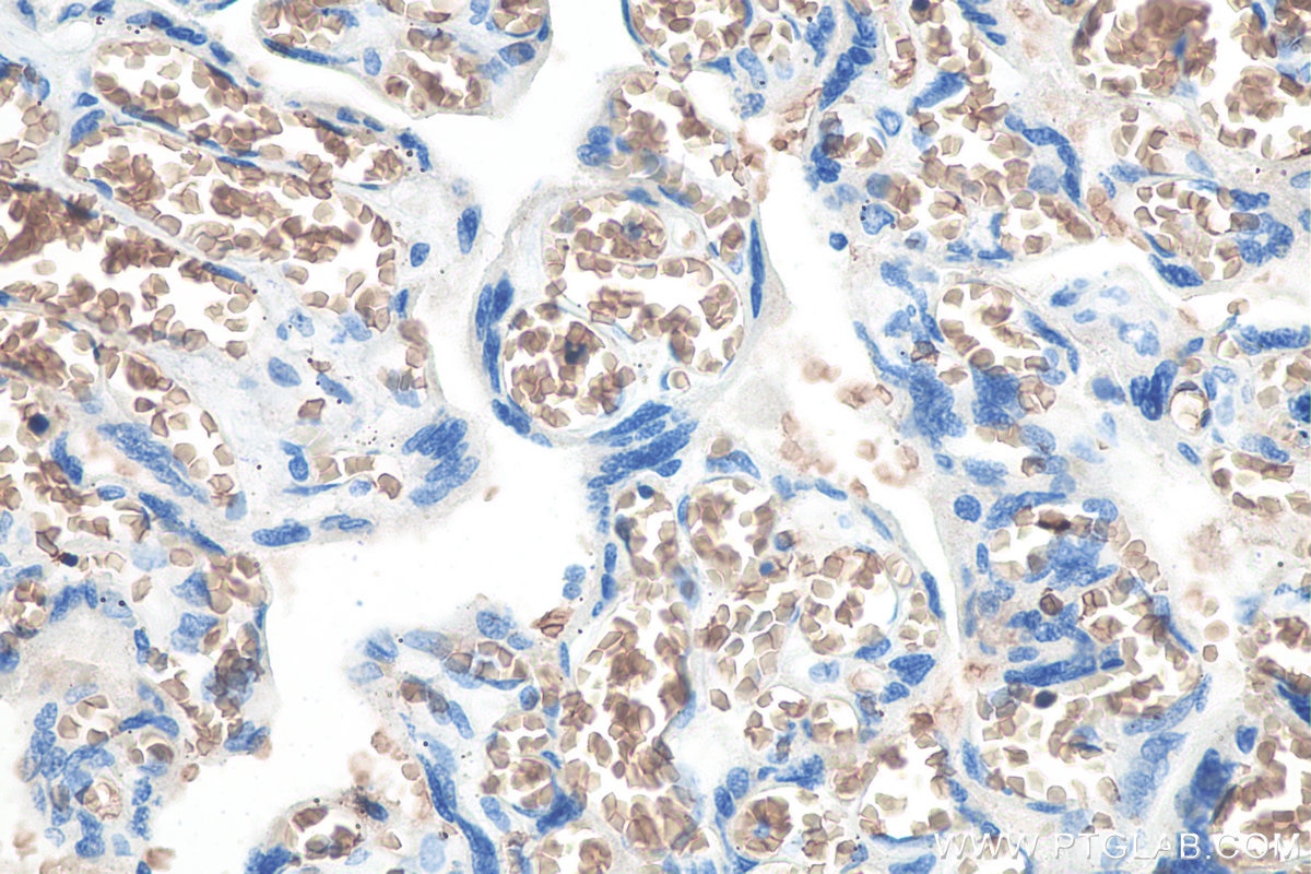 IHC staining of human placenta using 67714-1-Ig Immunohistochemistry (IHC) staining of human placenta tissue using RHAG Monoclonal antibody (67714-1-Ig)