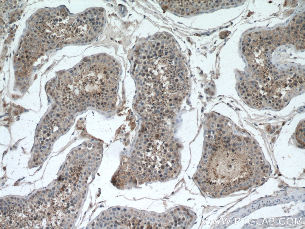 Immunohistochemistry (IHC) staining of human testis tissue using RHBDD1 Polyclonal antibody (20869-1-AP)