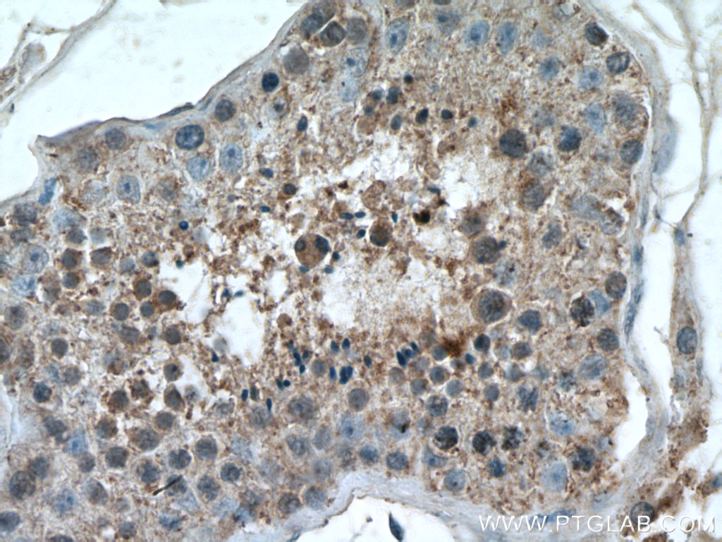 Immunohistochemistry (IHC) staining of human testis tissue using RHBDD1 Polyclonal antibody (20869-1-AP)