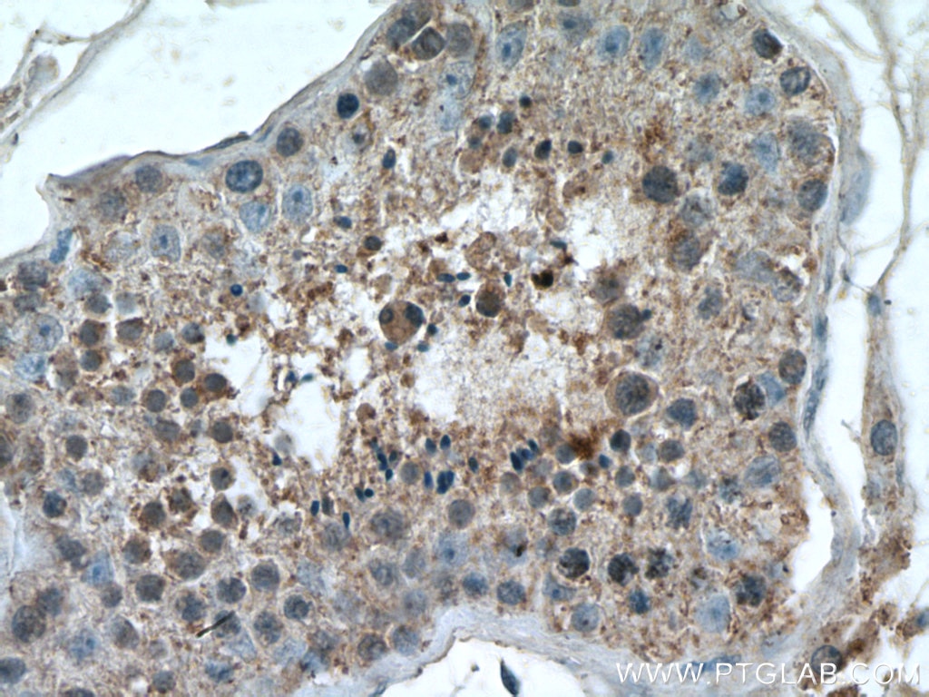 IHC staining of human testis using 20869-1-AP