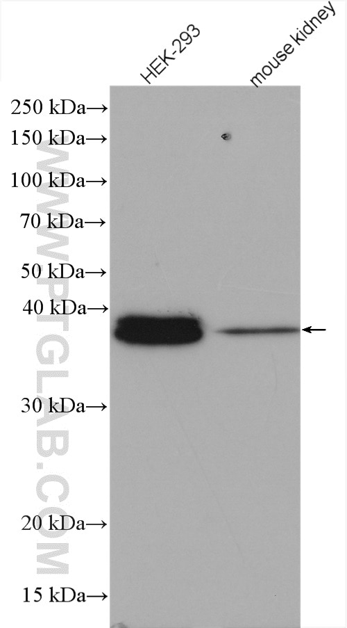 Western Blot (WB) analysis of various lysates using RHBDD1 Polyclonal antibody (20869-1-AP)