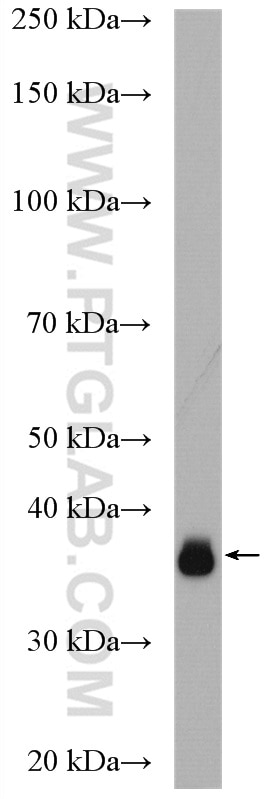 Western Blot (WB) analysis of mouse kidney tissue using RHBDD1 Polyclonal antibody (20869-1-AP)