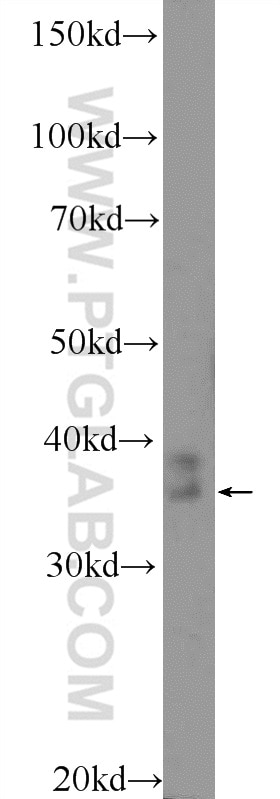 Western Blot (WB) analysis of mouse testis tissue using RHBDD1 Polyclonal antibody (20869-1-AP)