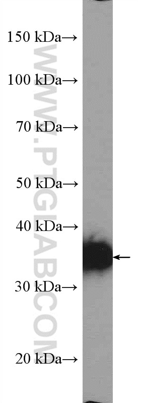 Western Blot (WB) analysis of HEK-293 cells using RHBDD1 Polyclonal antibody (20869-1-AP)