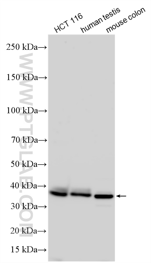 Western Blot (WB) analysis of various lysates using RHBDD1 Polyclonal antibody (20869-1-AP)