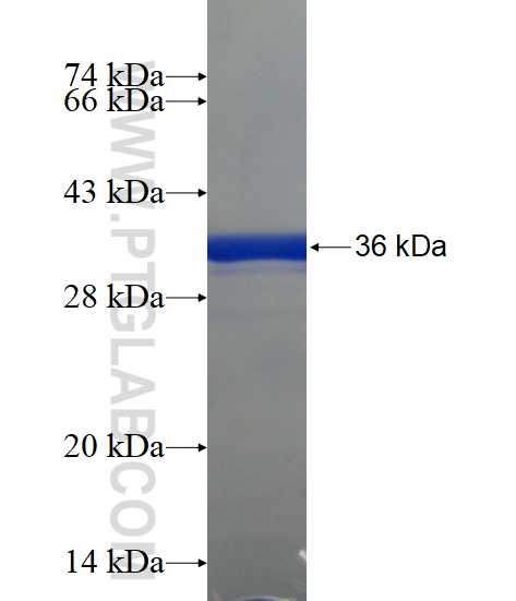 RHBDD1 fusion protein Ag14932 SDS-PAGE