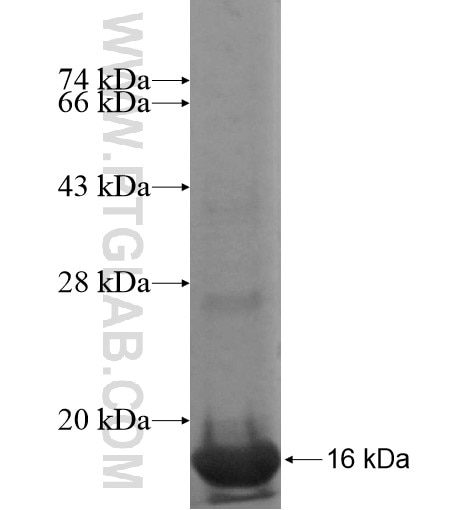 RHBDD1 fusion protein Ag15265 SDS-PAGE