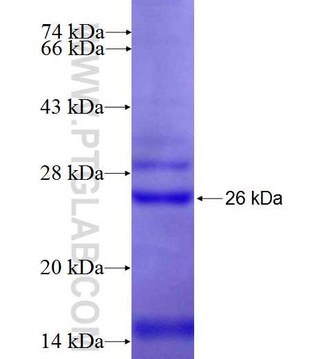 RHBDD2 fusion protein Ag23184 SDS-PAGE