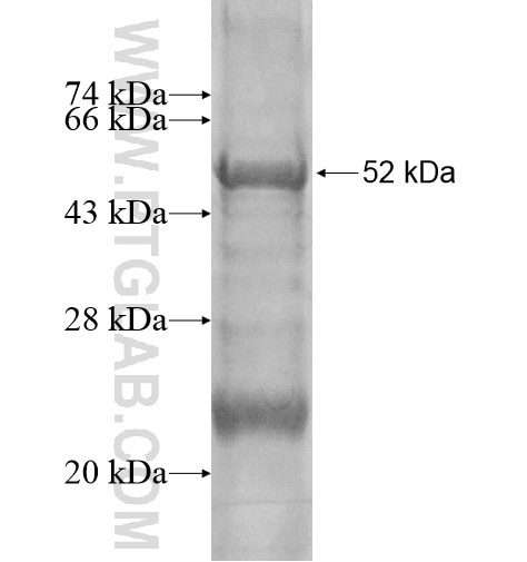 RHBDD3 fusion protein Ag14303 SDS-PAGE