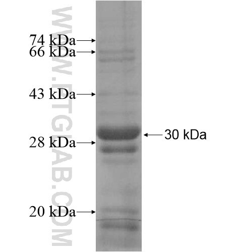 RHBDD3 fusion protein Ag14737 SDS-PAGE