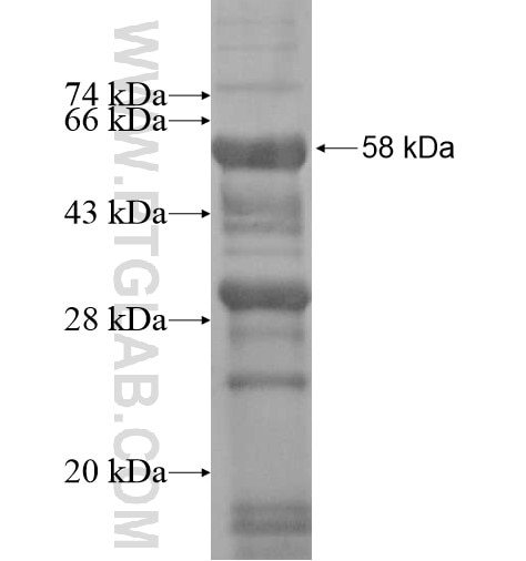 RHBDF1 fusion protein Ag13147 SDS-PAGE