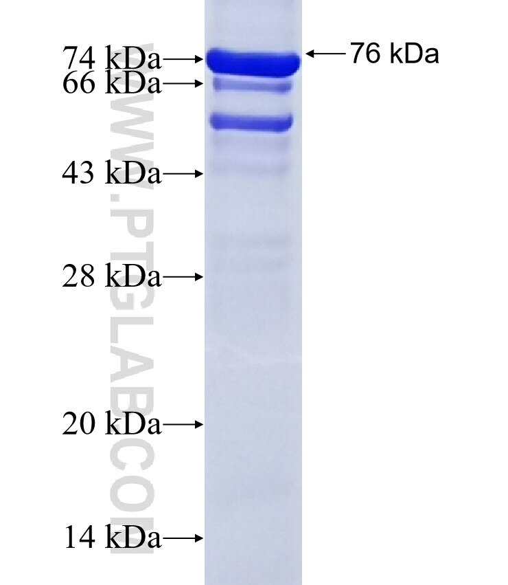 RHBDF1 fusion protein Ag13175 SDS-PAGE