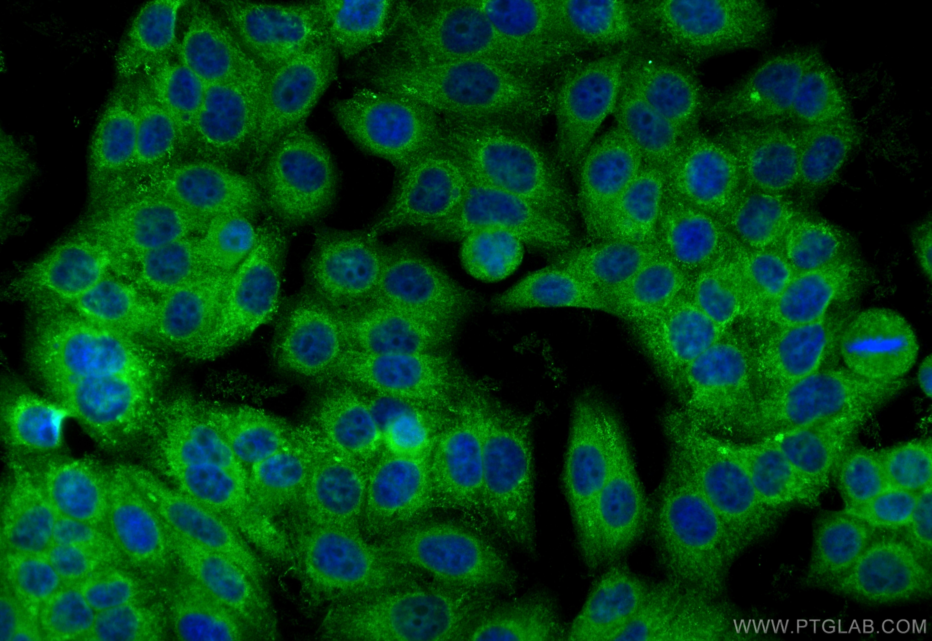 Immunofluorescence (IF) / fluorescent staining of HepG2 cells using RHBDF2 Polyclonal antibody (23181-1-AP)