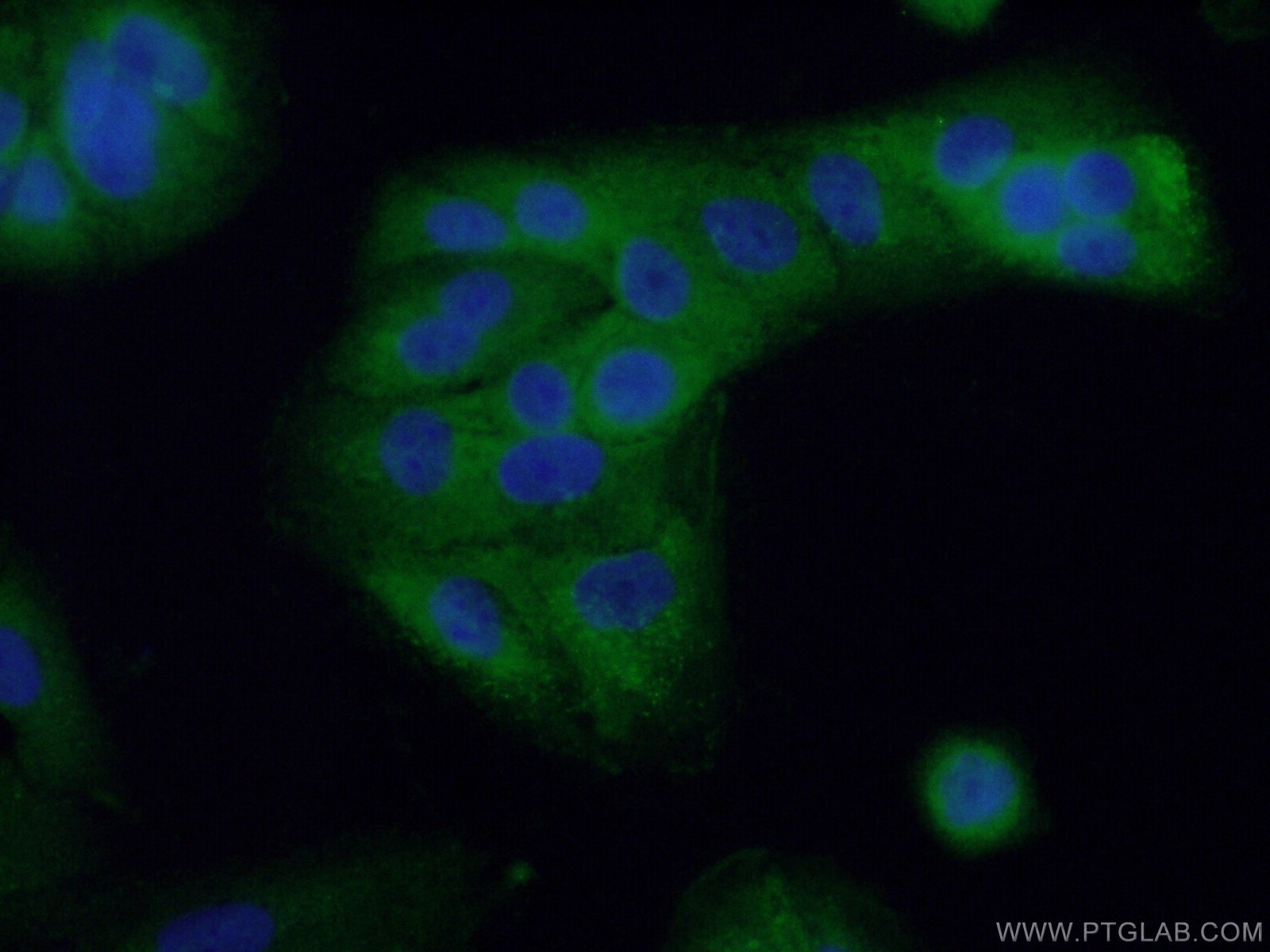 Immunofluorescence (IF) / fluorescent staining of A549 cells using RHBDF2 Polyclonal antibody (23181-1-AP)