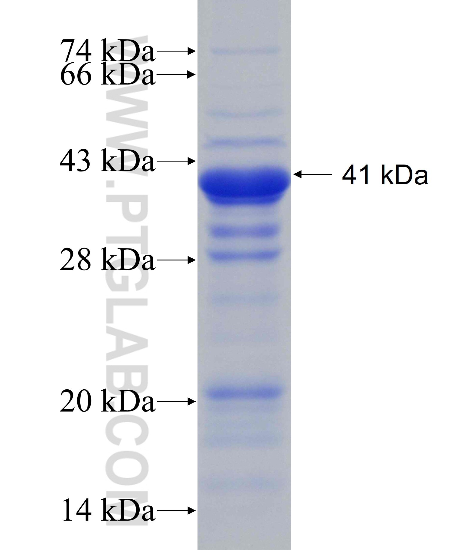 RHBDF2 fusion protein Ag19855 SDS-PAGE RHBDF2 fusion protein Ag19855 SDS-PAGE