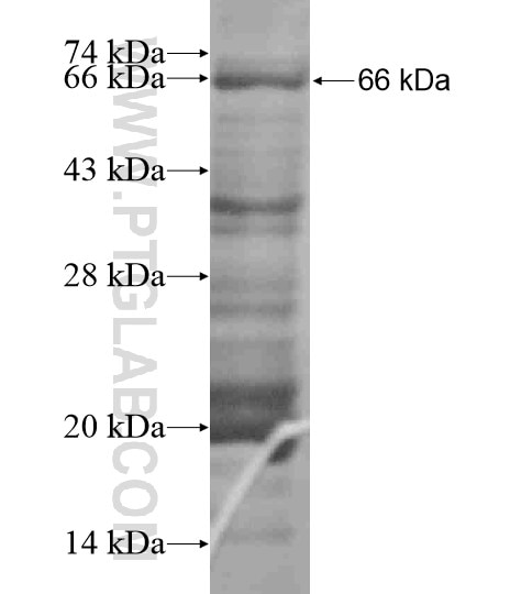 RHBDF2 fusion protein Ag19710 SDS-PAGE