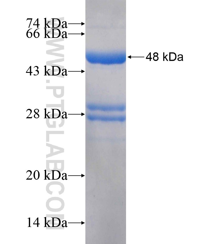 RHBDL1 fusion protein Ag18104 SDS-PAGE