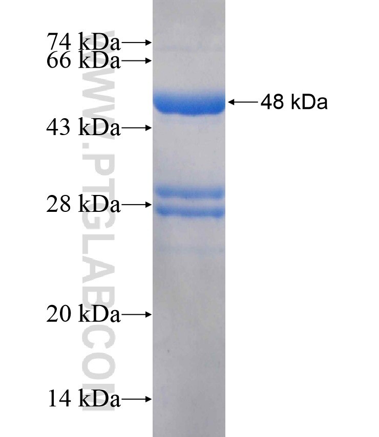 RHBDL1 fusion protein Ag18104 SDS-PAGE RHBDL1 fusion protein Ag18104 SDS-PAGE